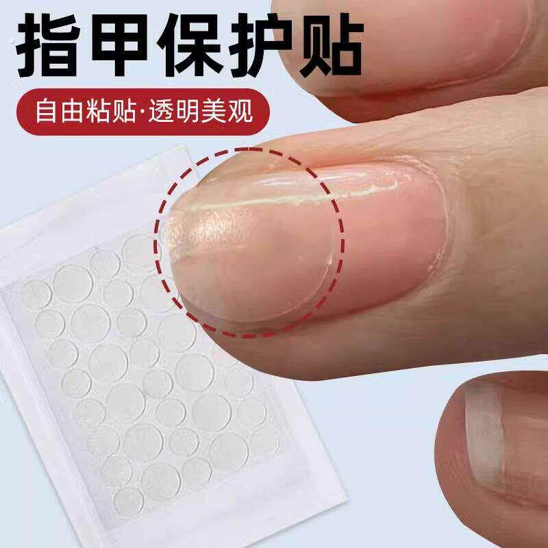 指甲防撞条指甲裂了保护透明自粘指甲防撞条指甲盖受伤保护套防水