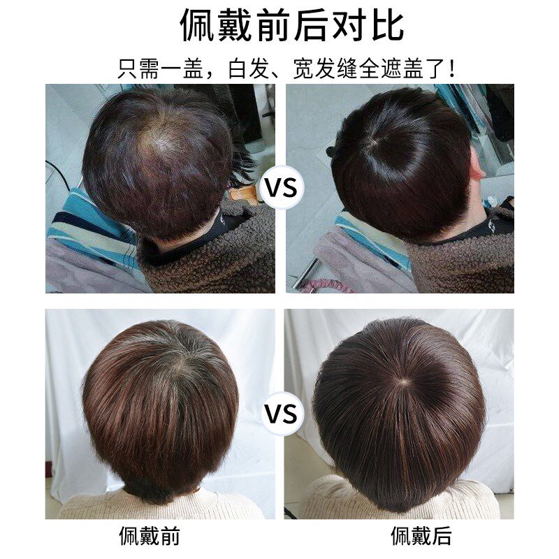 真发假发片头顶遮白发中老年大面积妈妈发自然无痕齐斜刘海假发女
