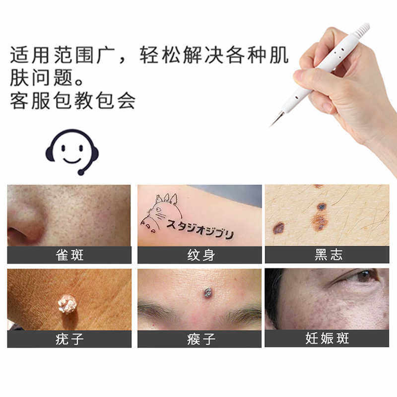 美容院专用扫斑笔激光祛斑神器电离子点斑仪器祛斑取痦小白笔机器