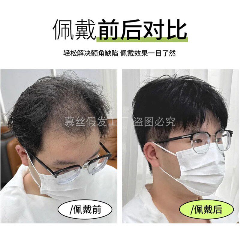 男士假发全递针NPU头顶补发片真发全头套双递针轻薄无痕新款透气