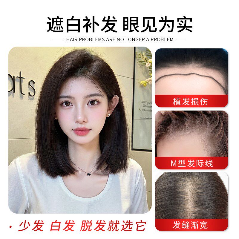 递针假发女片头顶补发蓬松真发遮白发增发量高颅顶轻薄刘海假发片
