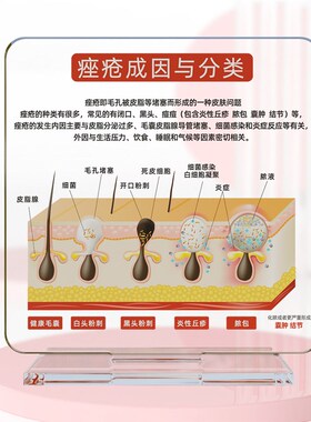医美知识展示牌四大问题肌肤成因亚克力桌牌高颜值桌牌斑敏痘衰