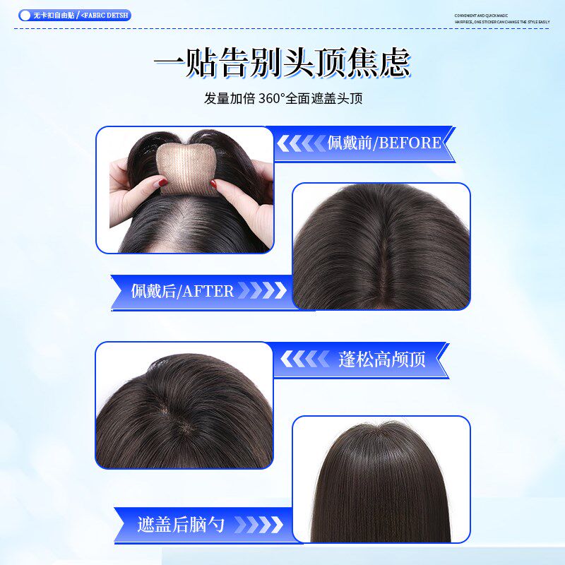 无需发夹发缝魔术贴假发女片头顶全真发增发量蓬松遮白发无痕补发