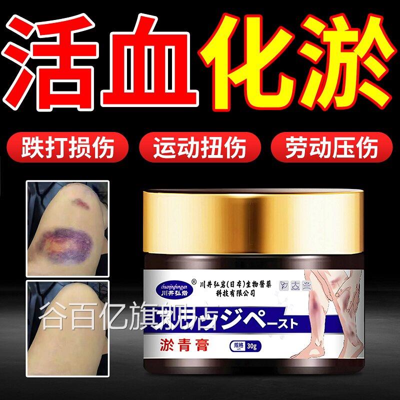 儿童淤青膏活血化瘀淤青速消除撞伤摔伤散淤血成人消肿快跌打损伤