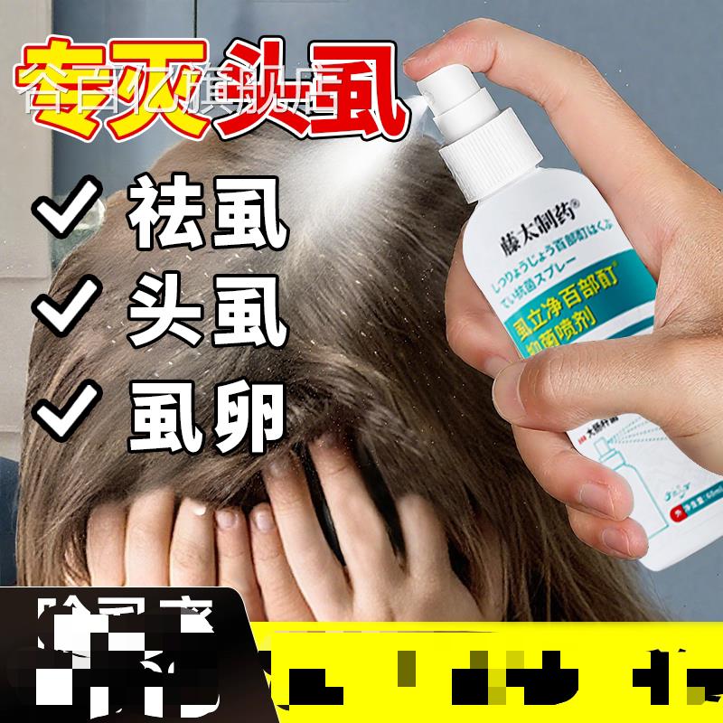百部酊虱子卵小女孩头发虱立净去虱儿童头上长虱子百部酊灭头发虱