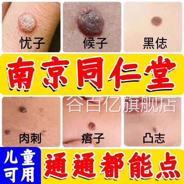 点志膏无痕去非药水去黑脸部美祛容不留疤官方正品旗舰店nn谷百亿