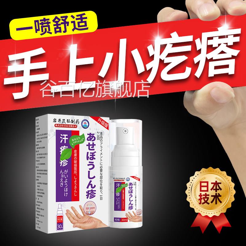 手上起小水泡汗状疱疹止痒止汗状真菌感染药膏去手上痒根起小疙瘩