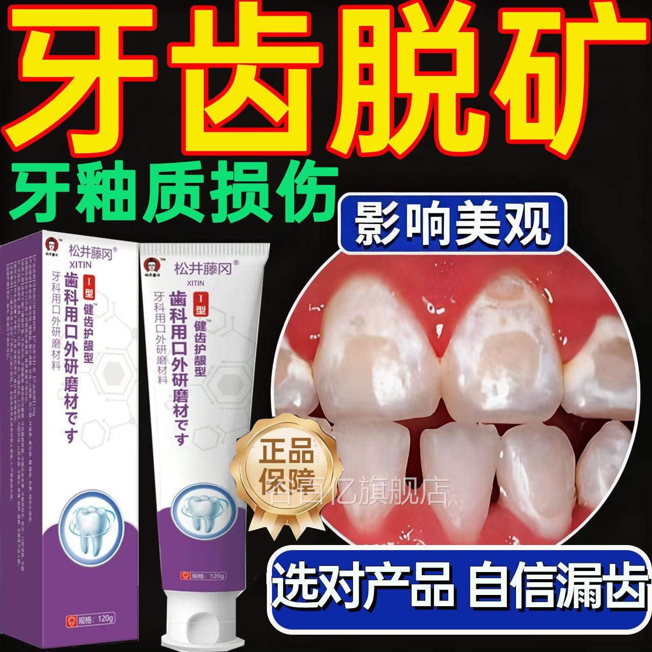 牙齿脱矿酸软痛牙釉质损伤白斑化含氟修复补矿钙再矿化专用牙膏UU