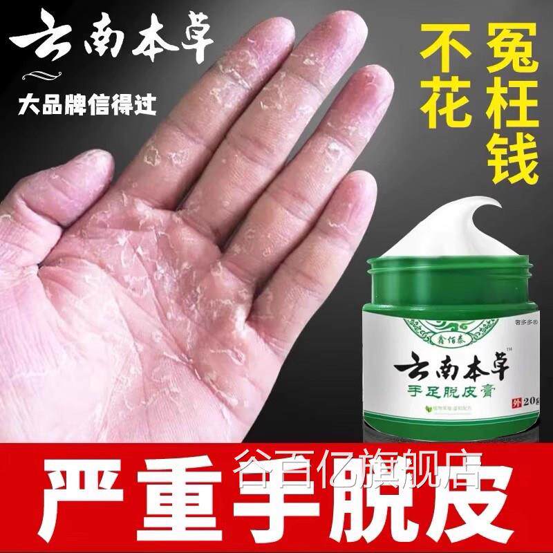 手足脱皮膏手指上真菌蜕皮干褪燥起皮童手掌蜕皮手心手足掉皮专用