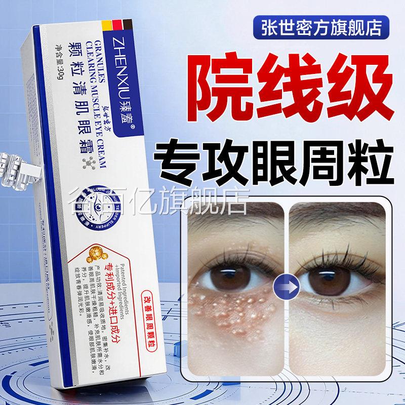 眼部脂肪颗粒眼霜汗油脂管眼周眼角男女士膏去除神器专用旗舰店谷