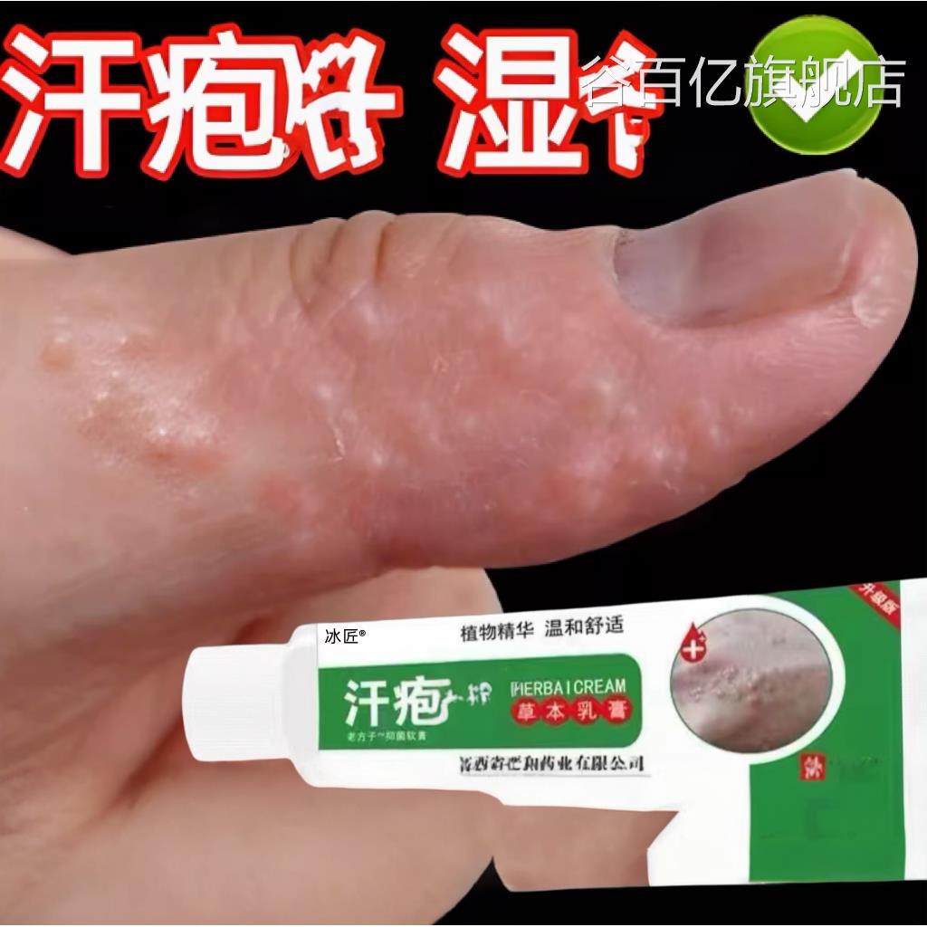 汗疱去手上起小水泡汉汗状菌真感染用软膏干裂脱皮痒根谷百亿旗舰