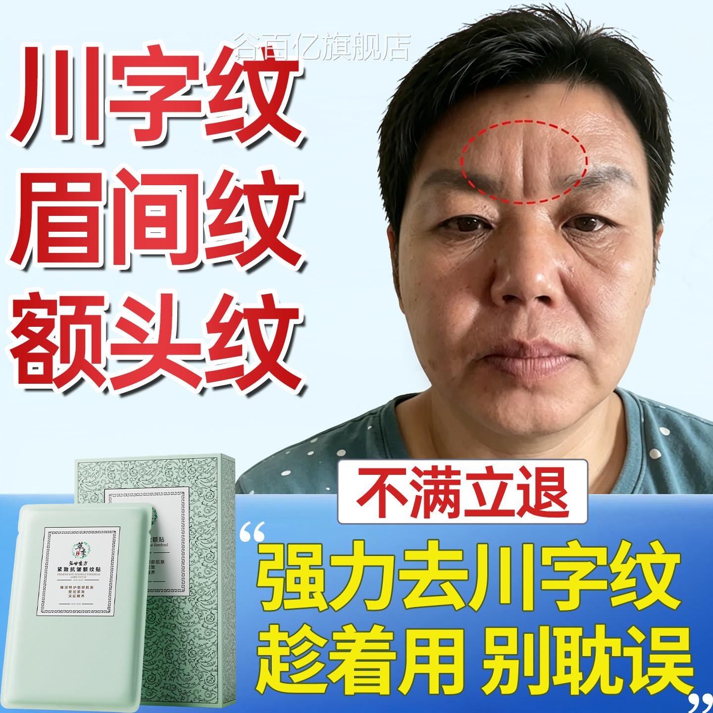 眉间川字纹去除神器额头抬头紧致抗皱睡眠觉男女专用贴官方旗舰店