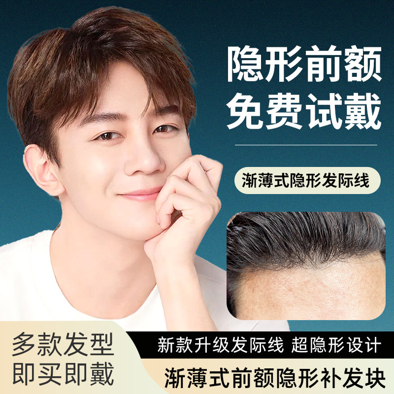假发男生头顶真h发织发块碎盖短发发际线增发量刘海补发片帅气无