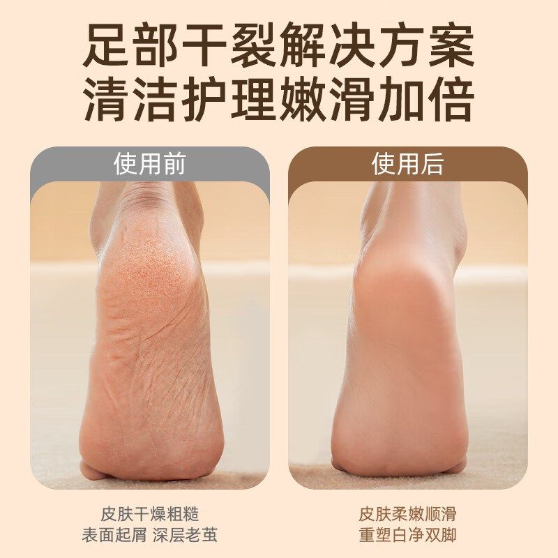 2025新款电动磨脚器美甲店36W大功率去死皮脚后跟老茧修脚神器