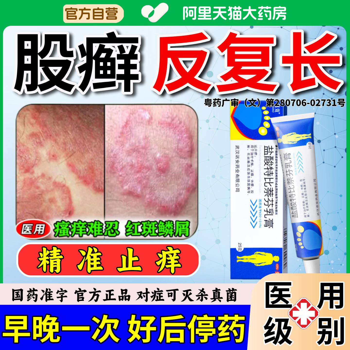 盐酸特比萘芬乳膏股藓专用药膏治大腿内侧潮湿瘙痒正品官方旗舰店