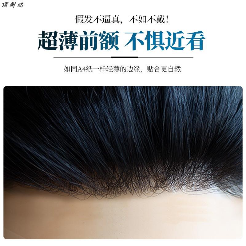 扎针男士全递针假发头顶补发片真人发丝超薄生物头皮发际线短直发
