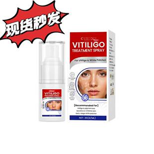 Vitiligo Treatment Spray 皮肤护理喷雾 均匀肌肤亮泽滋养