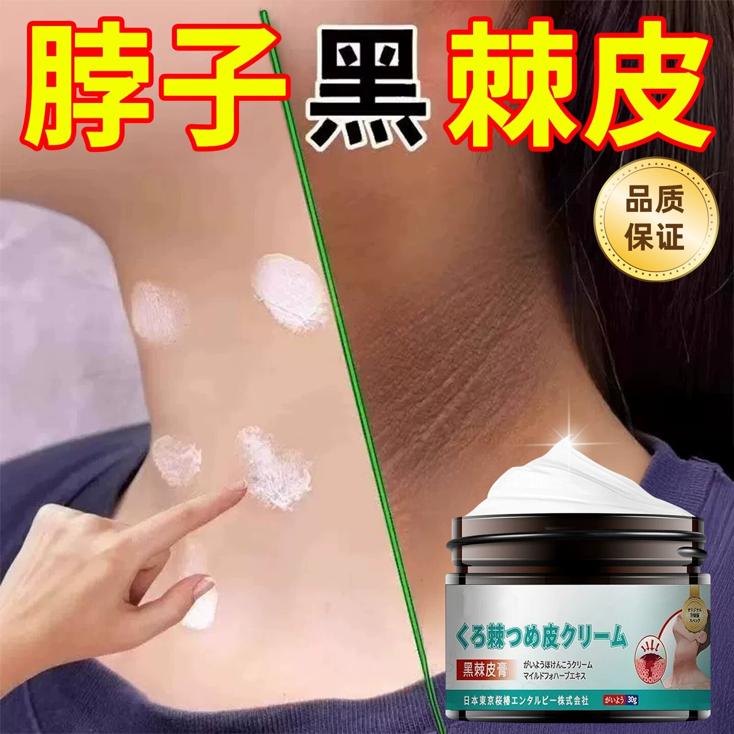 脖子黑色素去除黑棘皮膏色素沉淀成人儿童脖子腋下洗不干净通用30