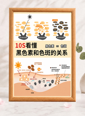 10S看懂黑色素和色斑关系挂画美容院皮肤管理装饰相框
