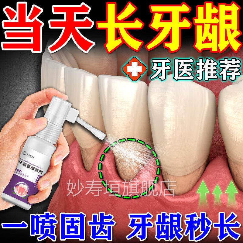 李时医药牙龈喷剂正品官方旗舰店牙齿珍修复萎缩松动固齿肿痛止痛