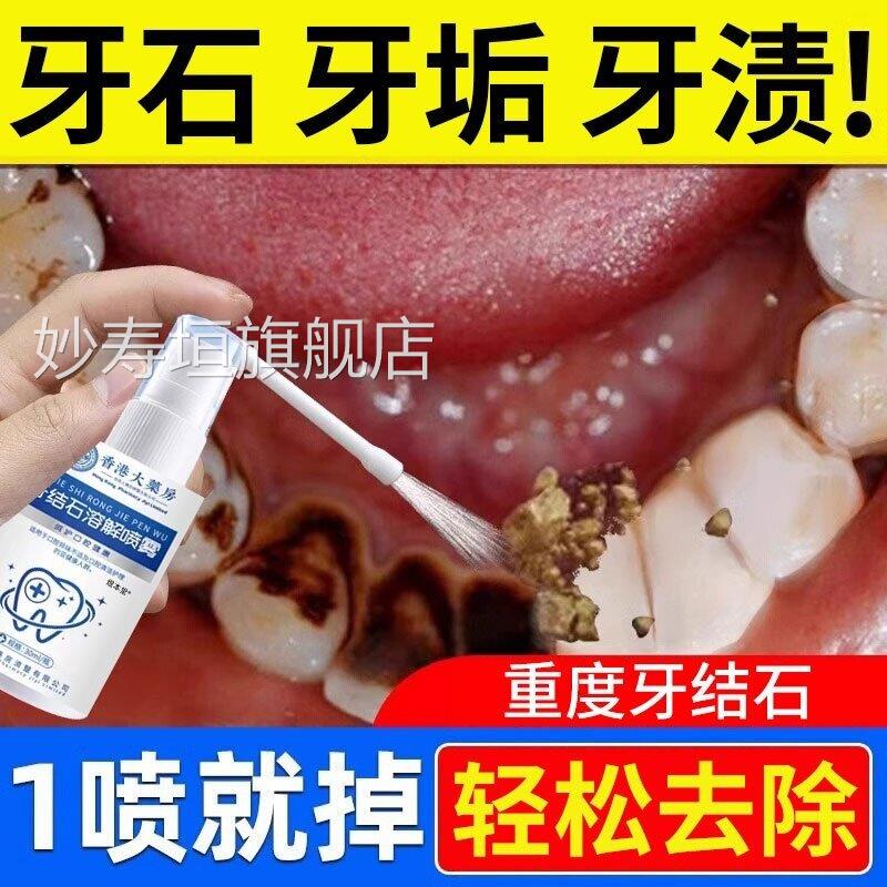 医用去牙结石溶解牙石速清效牙渍牙垢黄牙口理臭正品专用去除神器