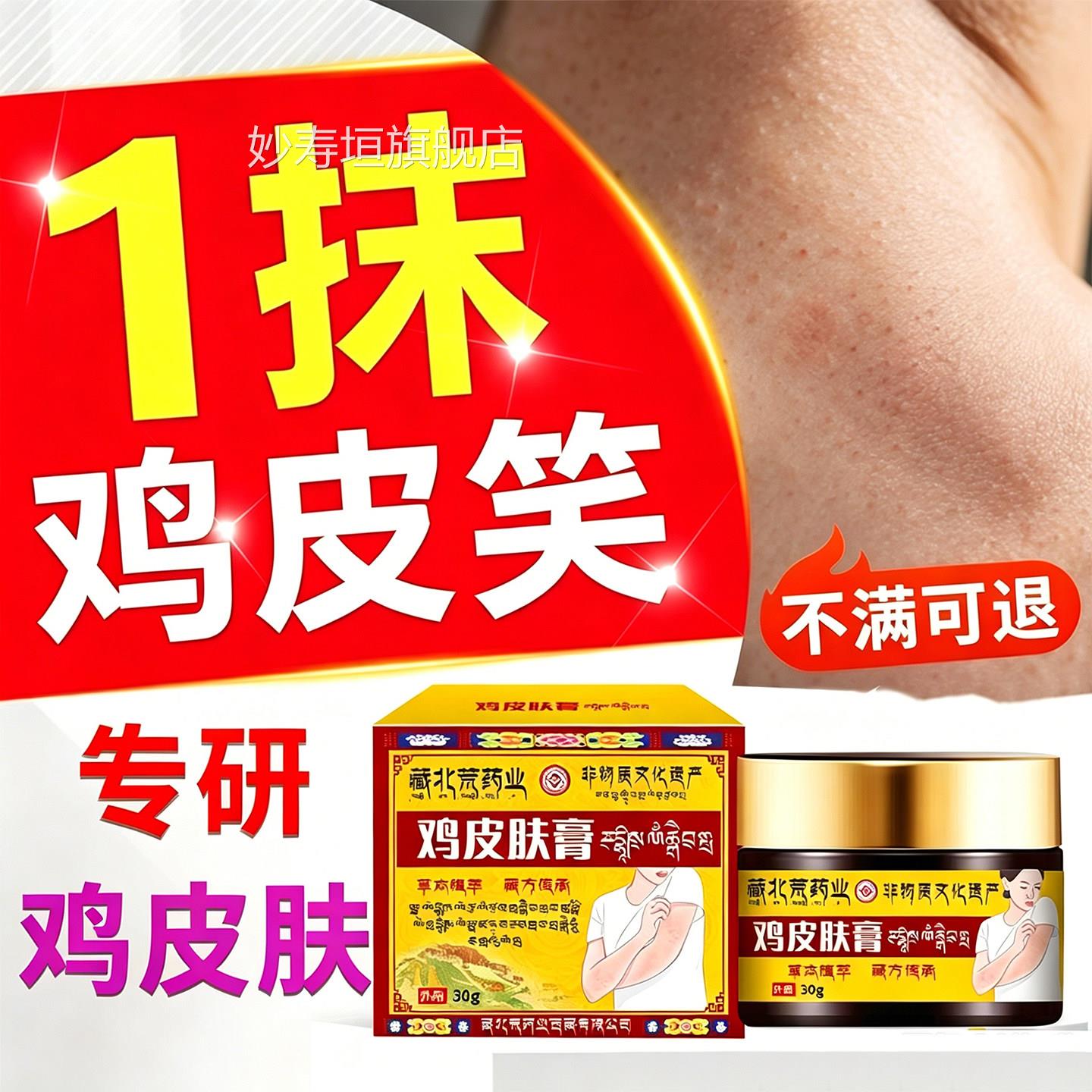 鸡皮肤疙瘩毛囊角化症药善膏去除全身手臂腿上起小黑点疙瘩改神器