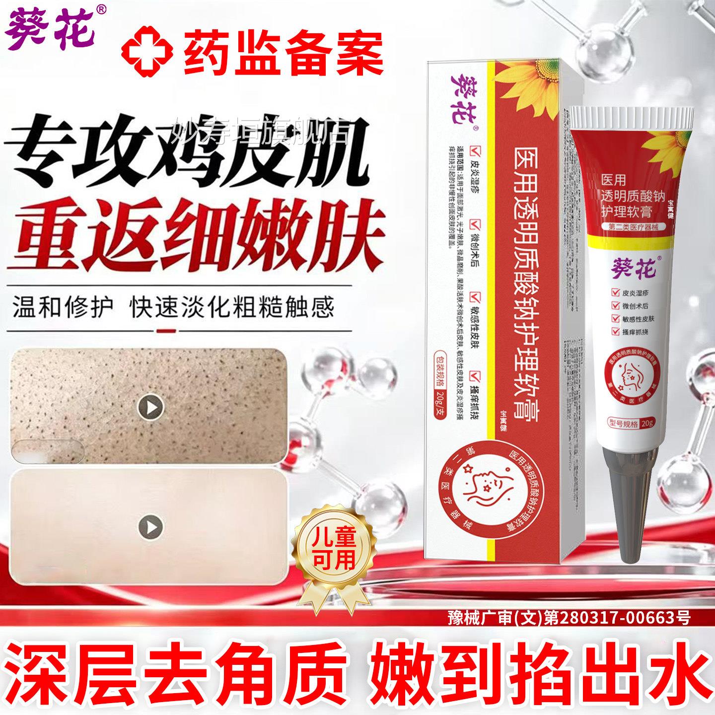 去鸡肤疙瘩毛囊角化角质药膏去除全身手臂腿胳膊鸡皮皮肤祛除神器
