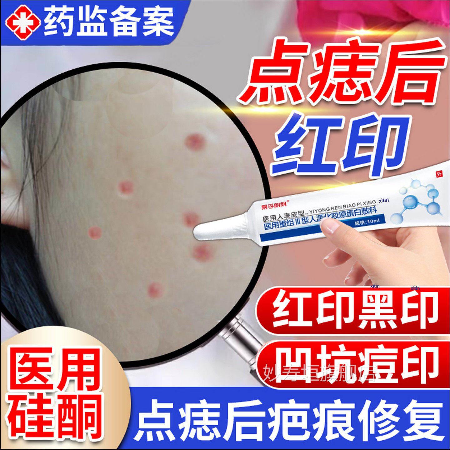 激光点斑祛痣点痣后去红红印修复膏退淡印液去痣凹陷疤痕专用TT妙