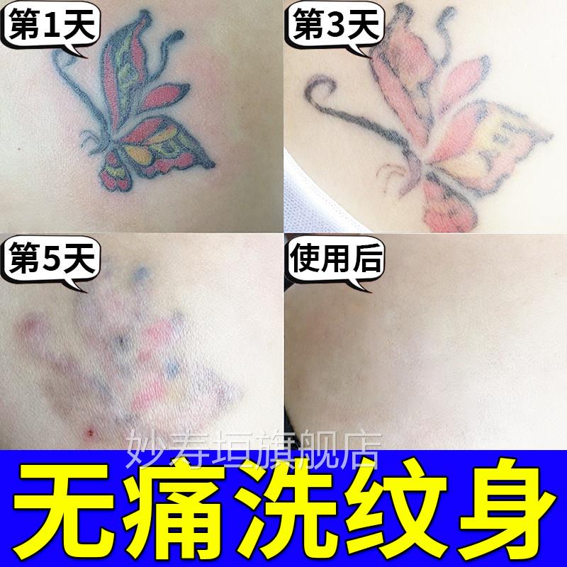 洗久祛纹身刺青非永去除药水专用修复膏专业无痛去除不留疤痕神器