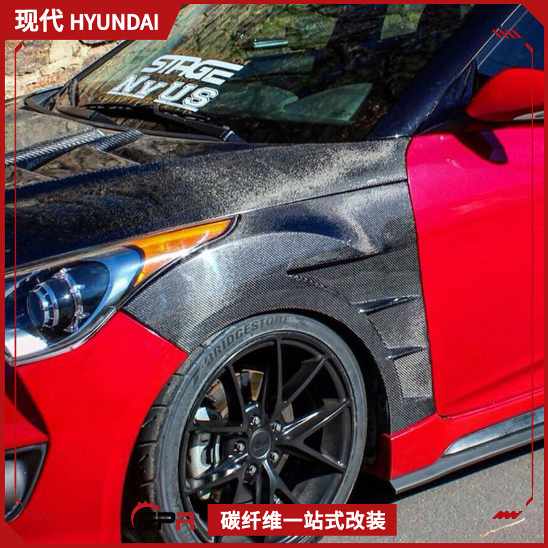 适用现代飞思 Veloster碳纤维改装件 EPA款开孔前叶子板 前头沙板