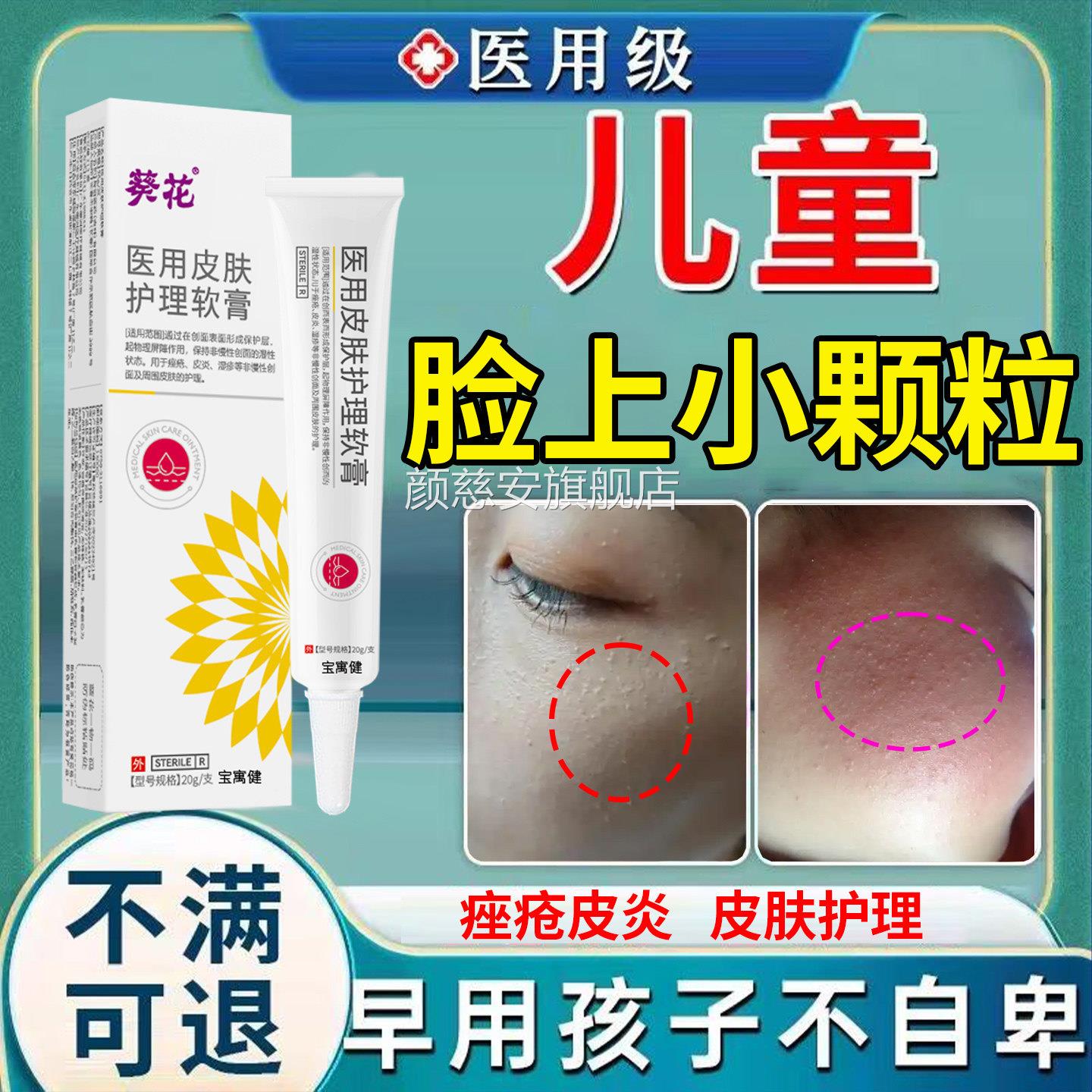 儿童脸上有小颗粒起疙瘩毛小周角化症去除脸部鸡皮肤小孩子毛囊炎