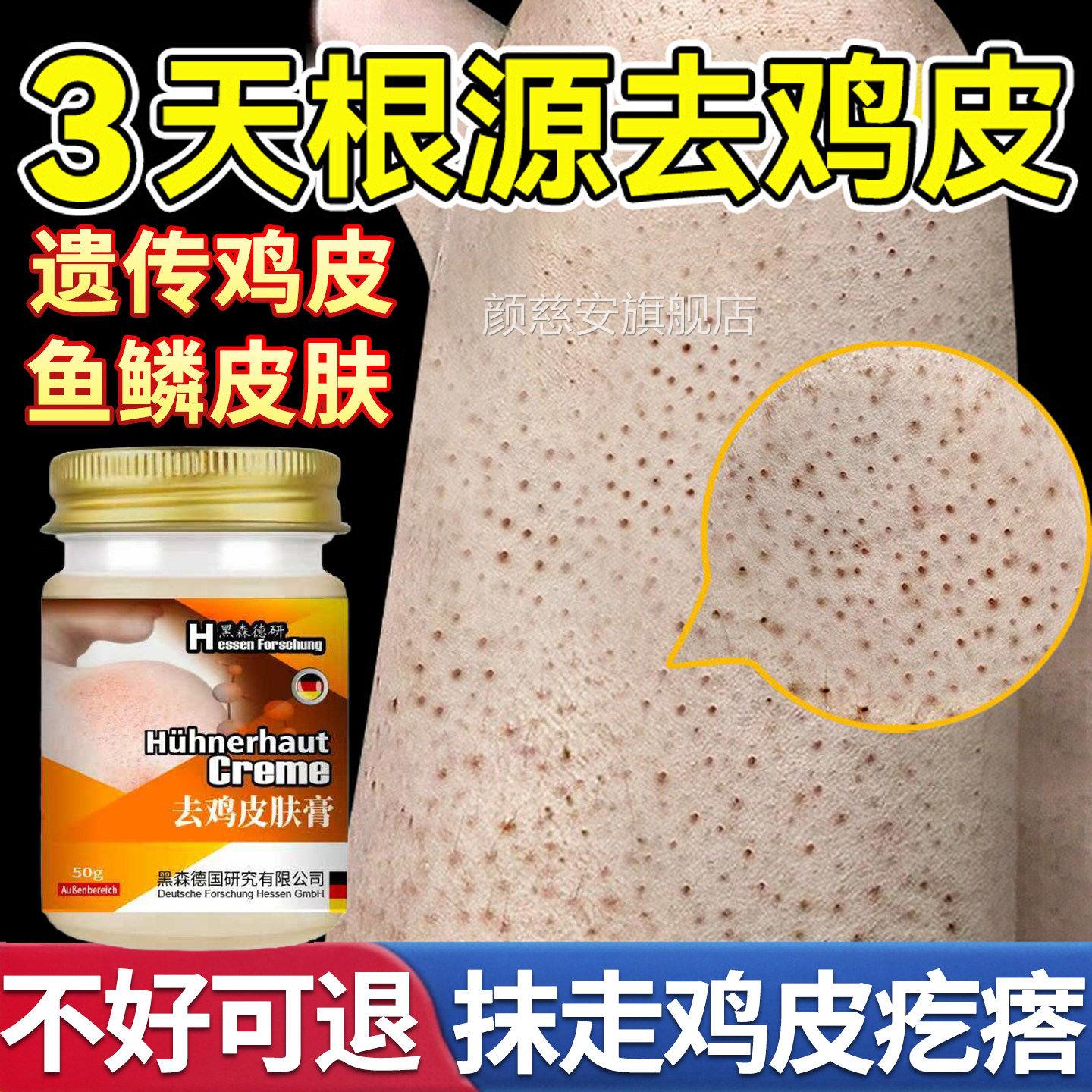 日本鸡皮肤疙瘩囊角化症专用膏去除全身手臂胳膊腿干燥起皮神毛器