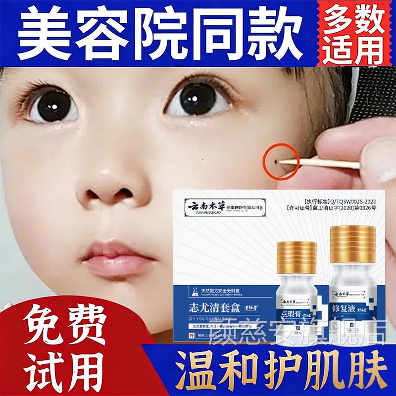 点痣膏痕正品药膏水点痣笔脸无部专用非药水液不留疤神器旗舰店ZZ