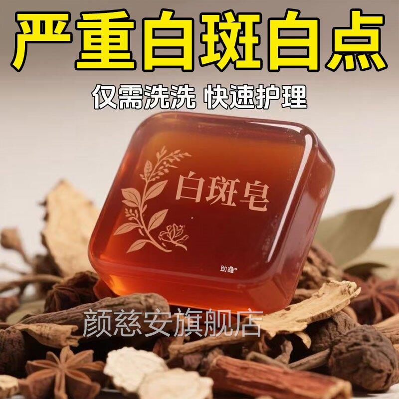 白癜骨香皂风外用黑色素生长特补脂酊专效用进口快速消白斑遮盖皂