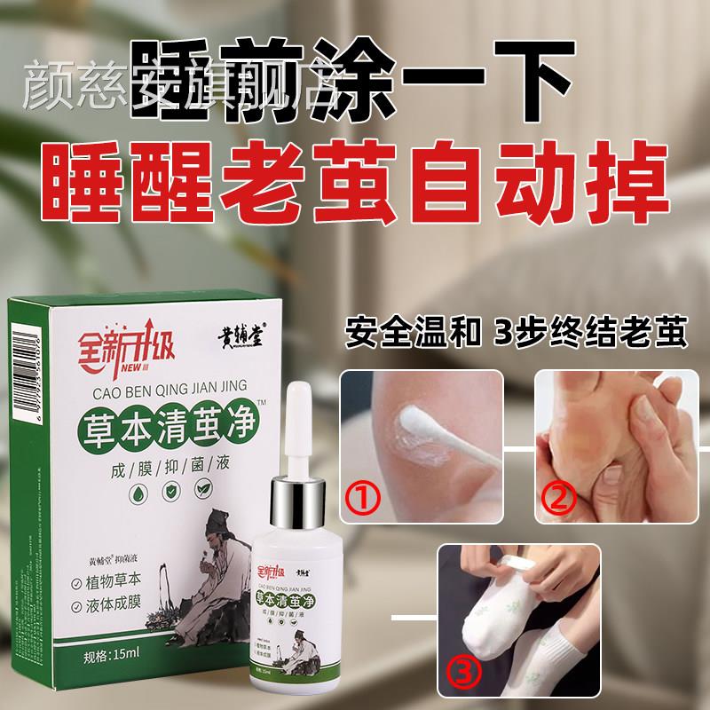 老茧去除软化剂手茧关节脚茧垫茧脚掌脚后跟去厚硬皮茧鸡膏眼神器