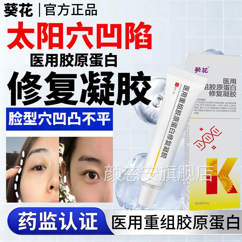 丰太阳穴面部凹陷填充神器医用重组三型源人化胶原蛋白修复凝胶L