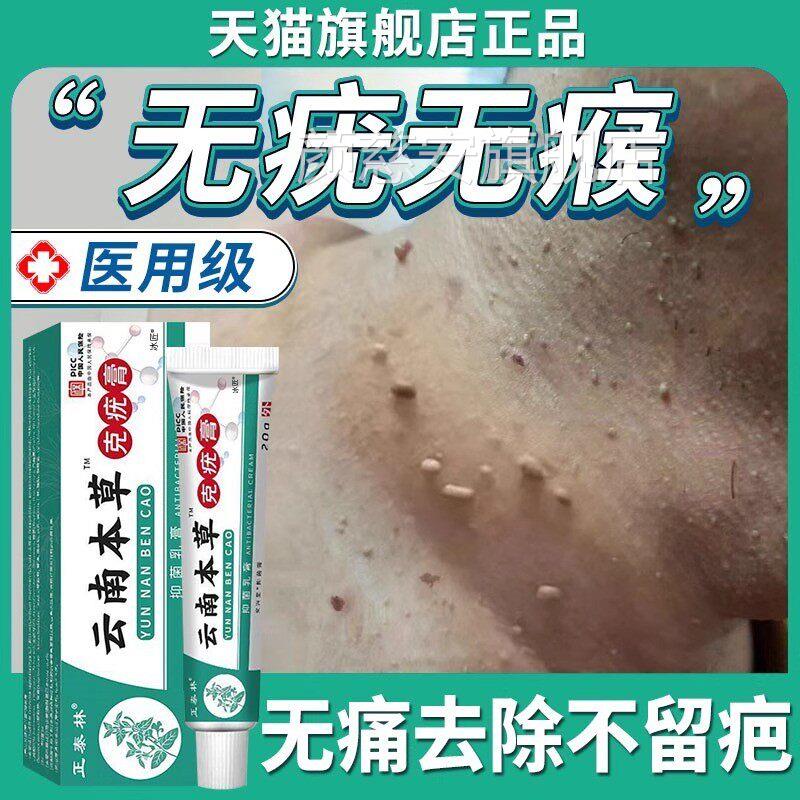 云南本草尤克尤膏去药膏水尤瘊子小肉粒扁平去除膏一抹灵斩草除根