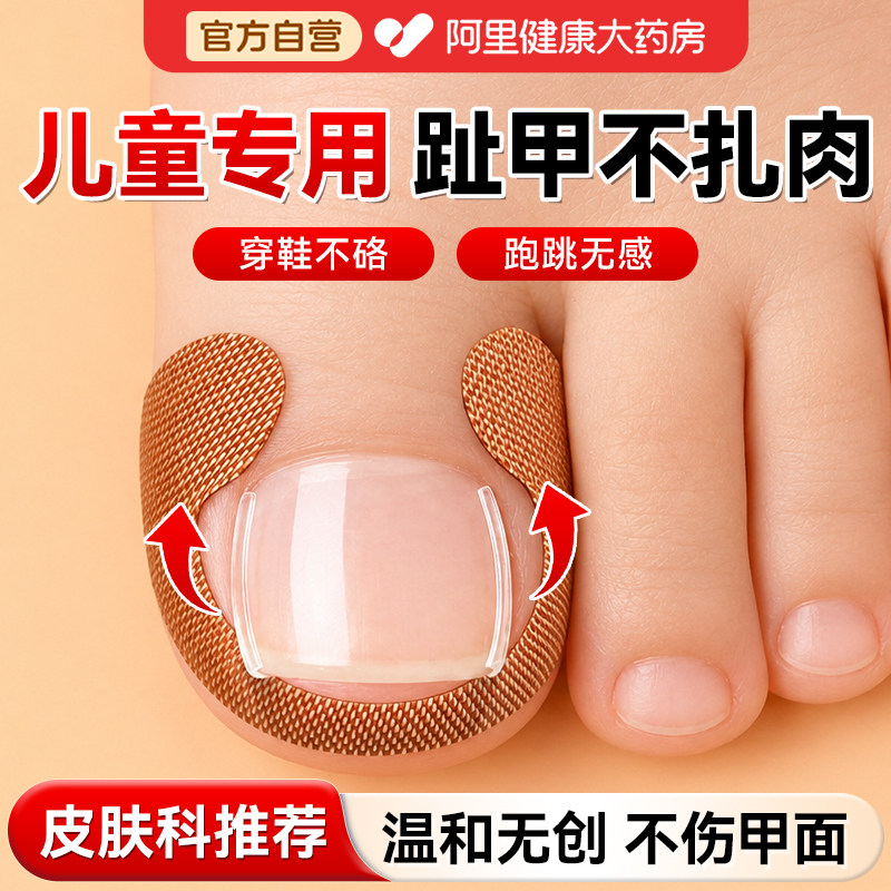 甲沟矫正器正甲贴片炎儿童嵌甲脚趾甲纠正器往肉里长专用隔离垫片