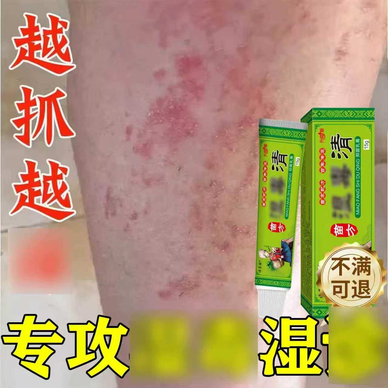 湿毒清抑菌软膏止痒皮肤专用药膏外用全身瘙痒旗舰店官方正品