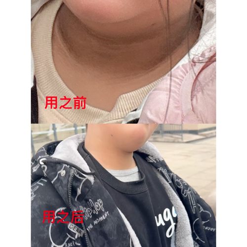 【小四粉丝专享】优赞焕采养肤凝胶洁净嫩肤光滑去角质220gA