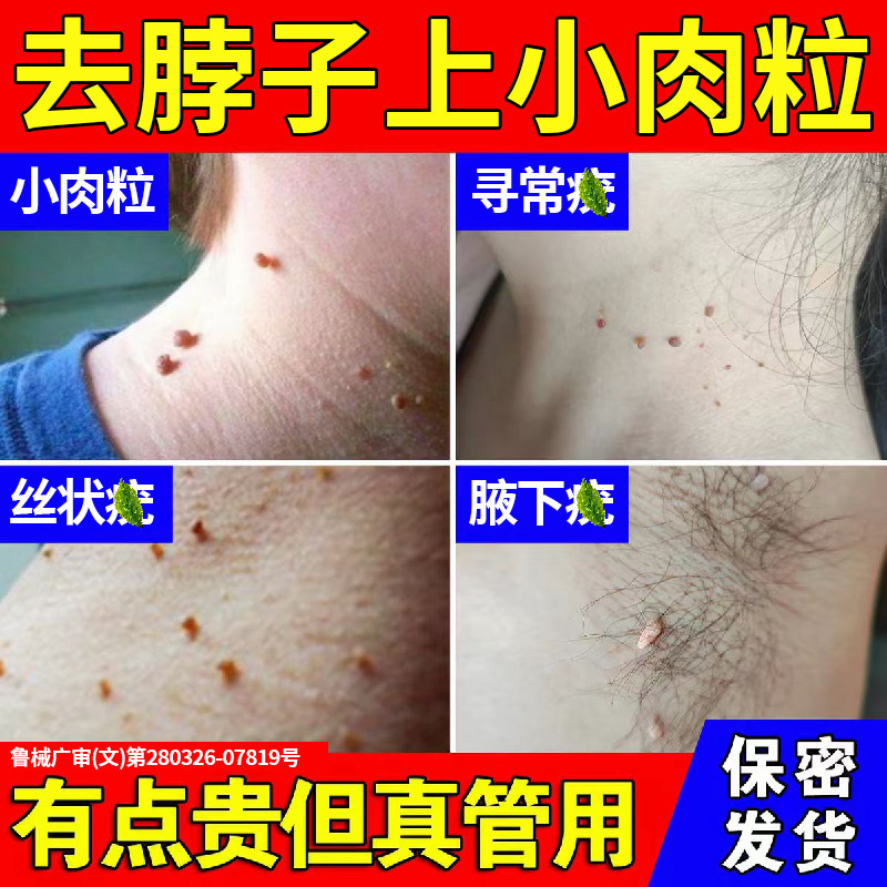 医用祛疣瘊丝状疣扁平疣去小肉粒去除膏一抹灵hpv生物凝胶软膏YB
