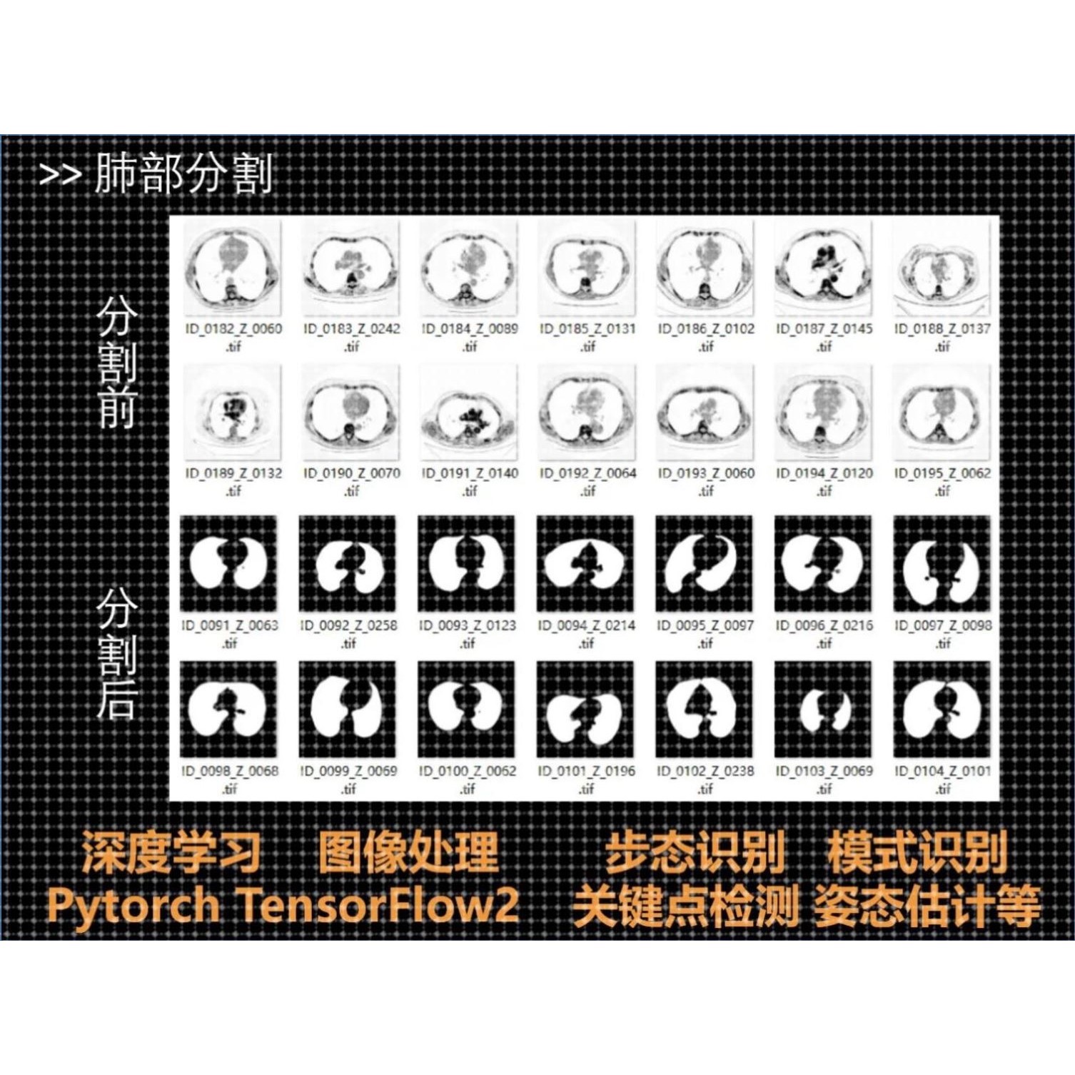 医学图像处理病理检测识别分割对抗生成网络算法项目程序界面制作
