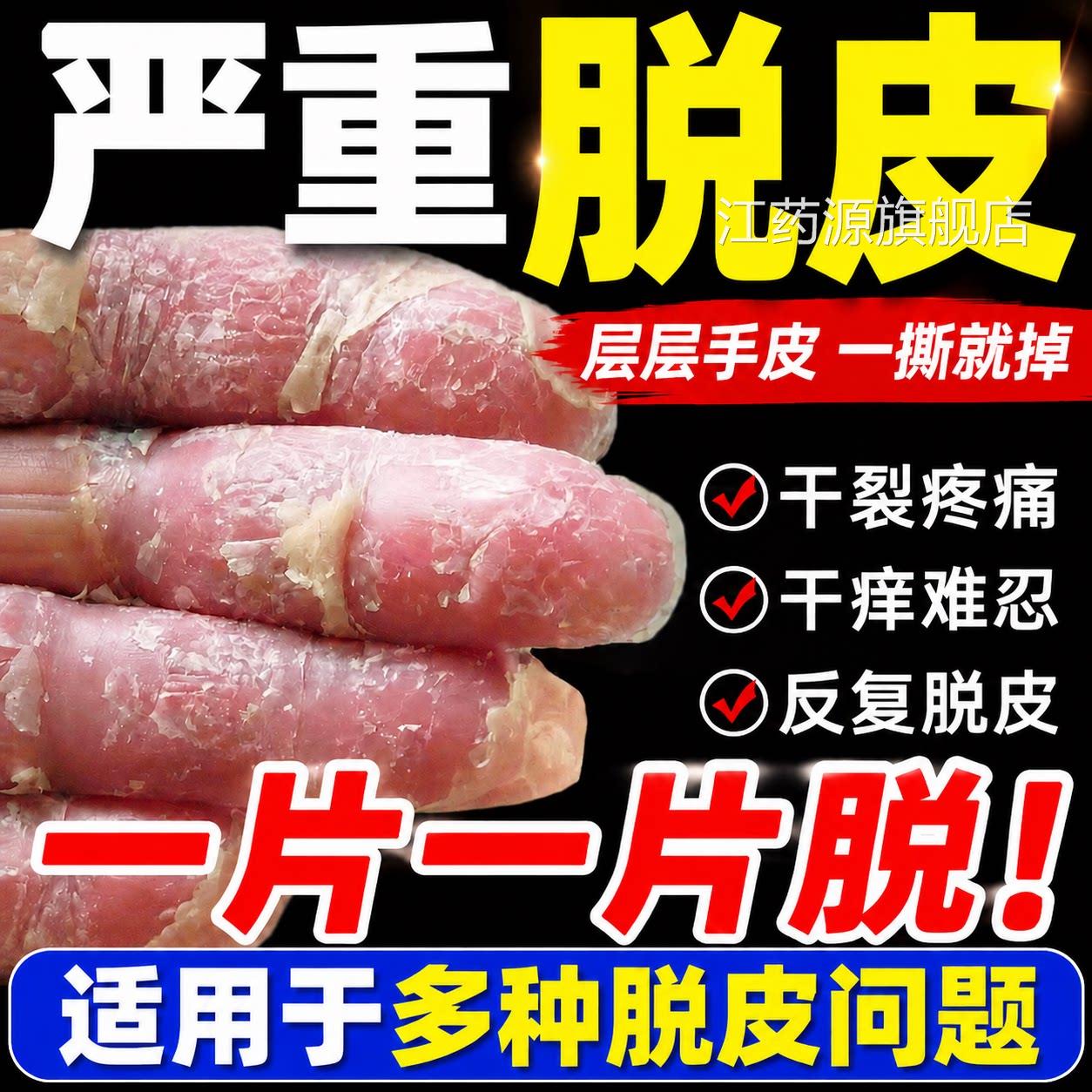 手足皮抑蜕皮菌膏严重真菌脚底干燥起皮感染脱专用官方旗舰店正品