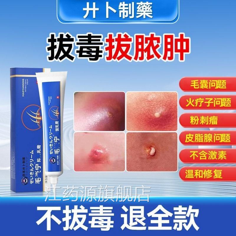 疖肿拔毒膏断痒拔毒膏火疖子的囊肿痛脓包皮腺痛私处外阴囊脂毛囊