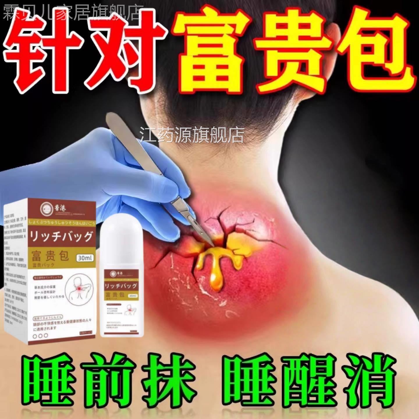 香港大房科研富贵包膏官方旗疼舰店正品脖子药前倾颈部鼓包痛专卖
