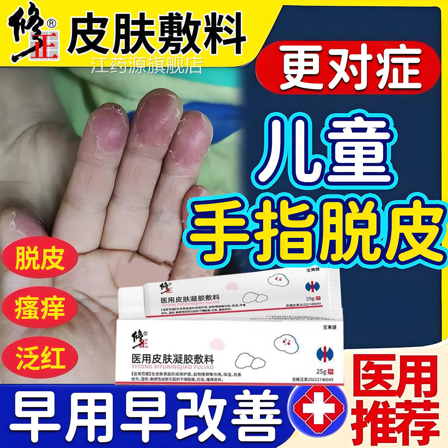 儿童手指脱皮药膏小孩手干裂口真菌剥感染脱性角质松懈症干燥粗糙
