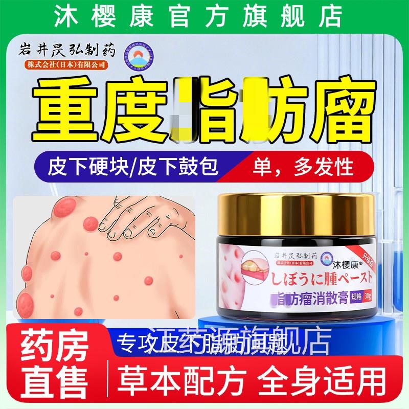 日本岩井脂肪消皮下鼓包肿块瘤非神器专用去除脂肪硬块膏瘤江药源