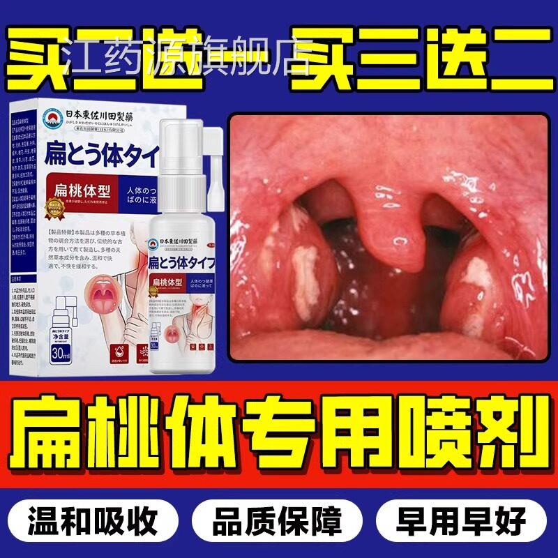日本特效扁桃体结石除工具漱口去水喷雾剂溶解隐窝冲洗器清理喷剂