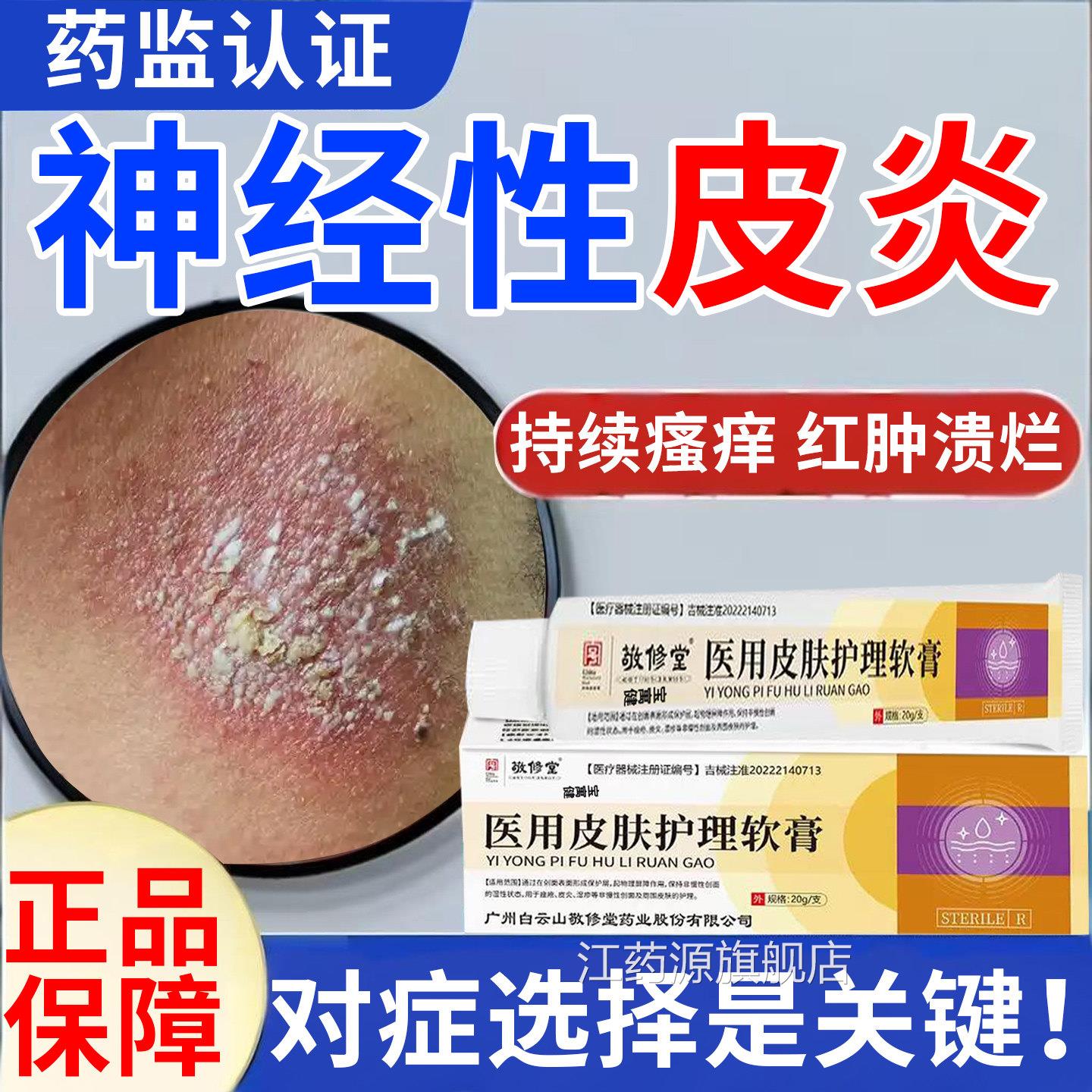 除神经性皮炎去祛外用膏顽固无激素皮肤痒止真菌感染非治疗根药江