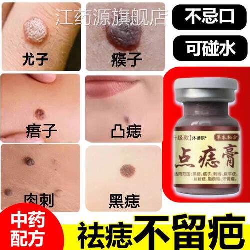 点痣痦子膏去脖子小肉粒尤猴去抑菌液腋下皮扁平尤祛丝状除尤江药